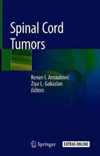 Spinal Cord Tumors