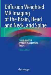 Diffusion Weighted MR Imaging of the Brain Head and Neck and Spine