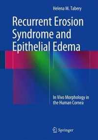 Recurrent Erosion Syndrome and Epithelial Edema