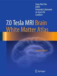 7.0 Tesla MRI Brain White Matter Atlas