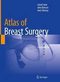 Atlas of Breast Surgery