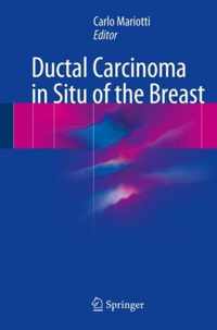 Ductal Carcinoma in Situ of the Breast