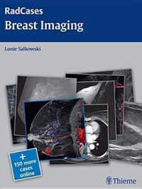 Breast Imaging RadCases