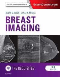 Breast Imaging: The Requisites