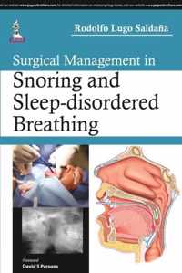 Surgical Management in Snoring and Sleep-disordered Breathing