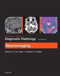 Grainger & Allison's Diagnostic Radiology: Neuroimaging