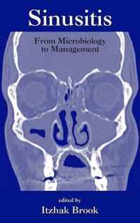 Sinusitis