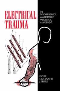 Electrical Trauma