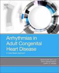 Arrhythmias in Adult Congenital Heart Disease