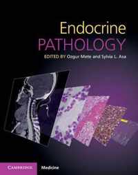 Endocrine Pathology with Online Resource