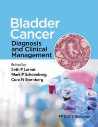 Bladder Cancer