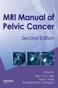 MRI Manual of Pelvic Cancer