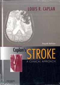 Caplan's Stroke