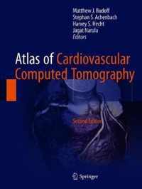 Atlas of Cardiovascular Computed Tomography