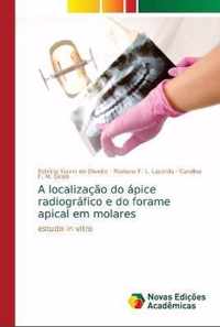 A localizacao do apice radiografico e do forame apical em molares