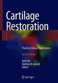 Cartilage Restoration