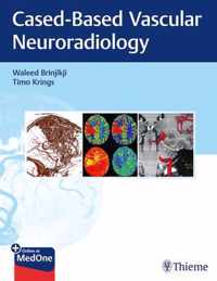 Imaging in Neurovascular Disease