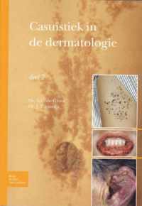 Casuïstiek in de dermatologie