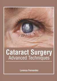 Cataract Surgery