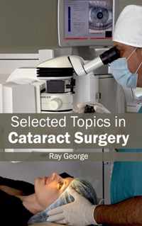 Selected Topics in Cataract Surgery