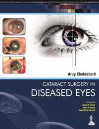 Cataract Surgery in Diseased Eyes