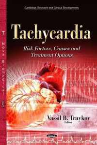 Tachycardia