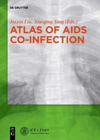 Atlas of AIDS Co-infection