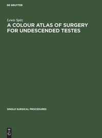 A Colour Atlas of Surgery for Undescended Testes