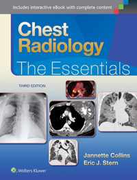 Chest Radiology