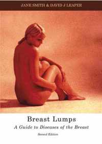 Breast Lumps