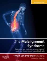 Malalignment Syndrome 2nd