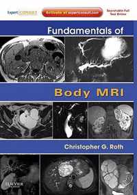 Fundamentals of Body MRI