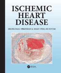 Ischemic Heart Disease