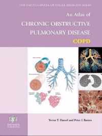 An Atlas of Chronic Obstructive Pulmonary Disease