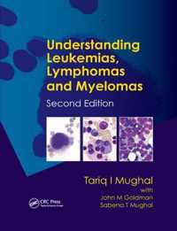 Understanding Leukemias, Lymphomas and Myelomas