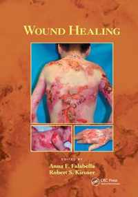 Wound Healing