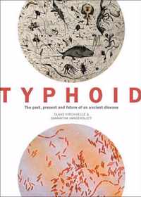 Typhoid