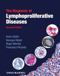 The Diagnosis of Lymphoproliferative Diseases