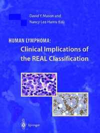 Human Lymphoma