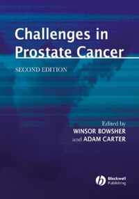 Challenges in Prostate Cancer