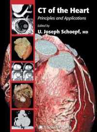 CT of the Heart