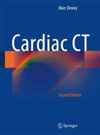 Cardiac CT