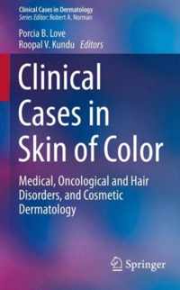 Clinical Cases in Skin of Color