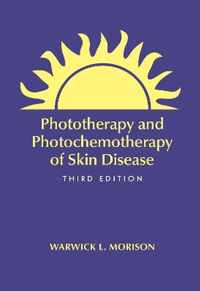 Phototherapy and Photochemotherapy for Skin Disease