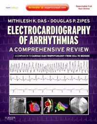 Electrocardiography of Arrhythmias: A Comprehensive Review