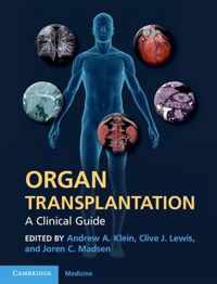 Organ Transplantation