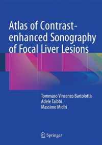 Atlas of Contrast-enhanced Sonography of Focal Liver Lesions