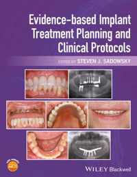 Evidence-based Implant Treatment Planning and Clinical Protocols