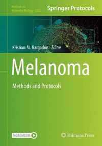 Melanoma