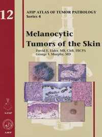 Melanocytic Tumors of the Skin